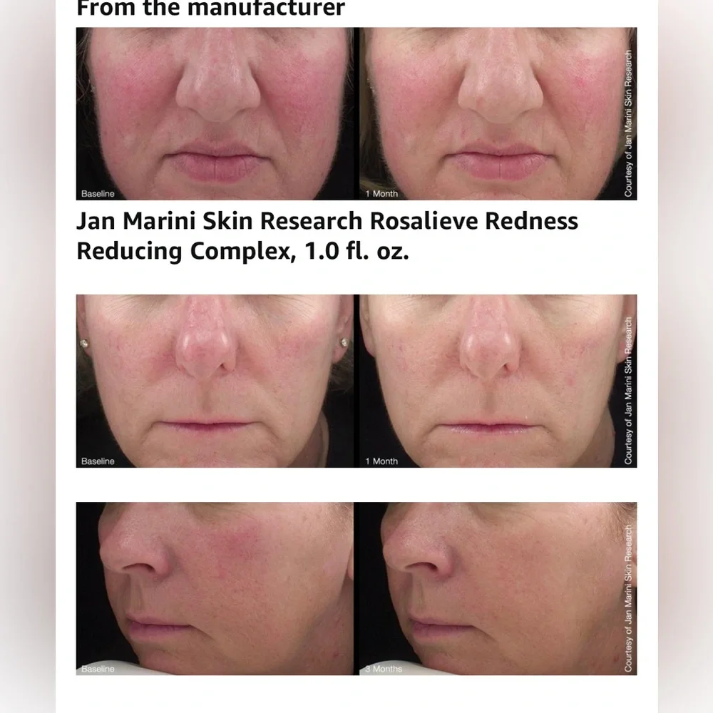 NIB Jan Marini rosalieve redness reducing complex - Picture 5 of 5